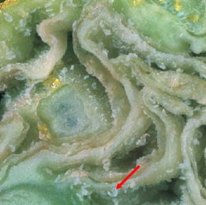 Микроскопические клещи на почке смородины